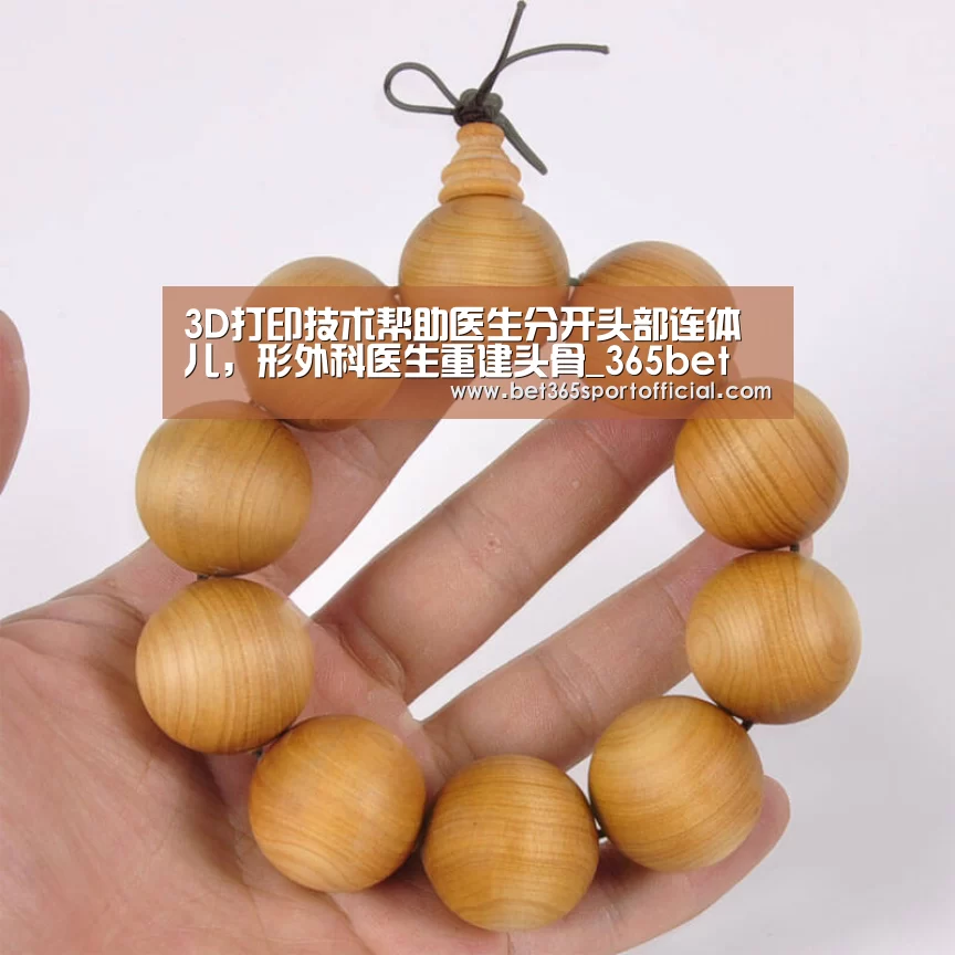 3D打印技术帮助医生分开头部连体儿，形外科医生重建头骨_365bet(图2)
