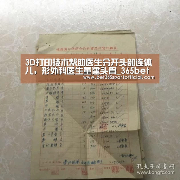 3D打印技术帮助医生分开头部连体儿，形外科医生重建头骨_365bet(图4)